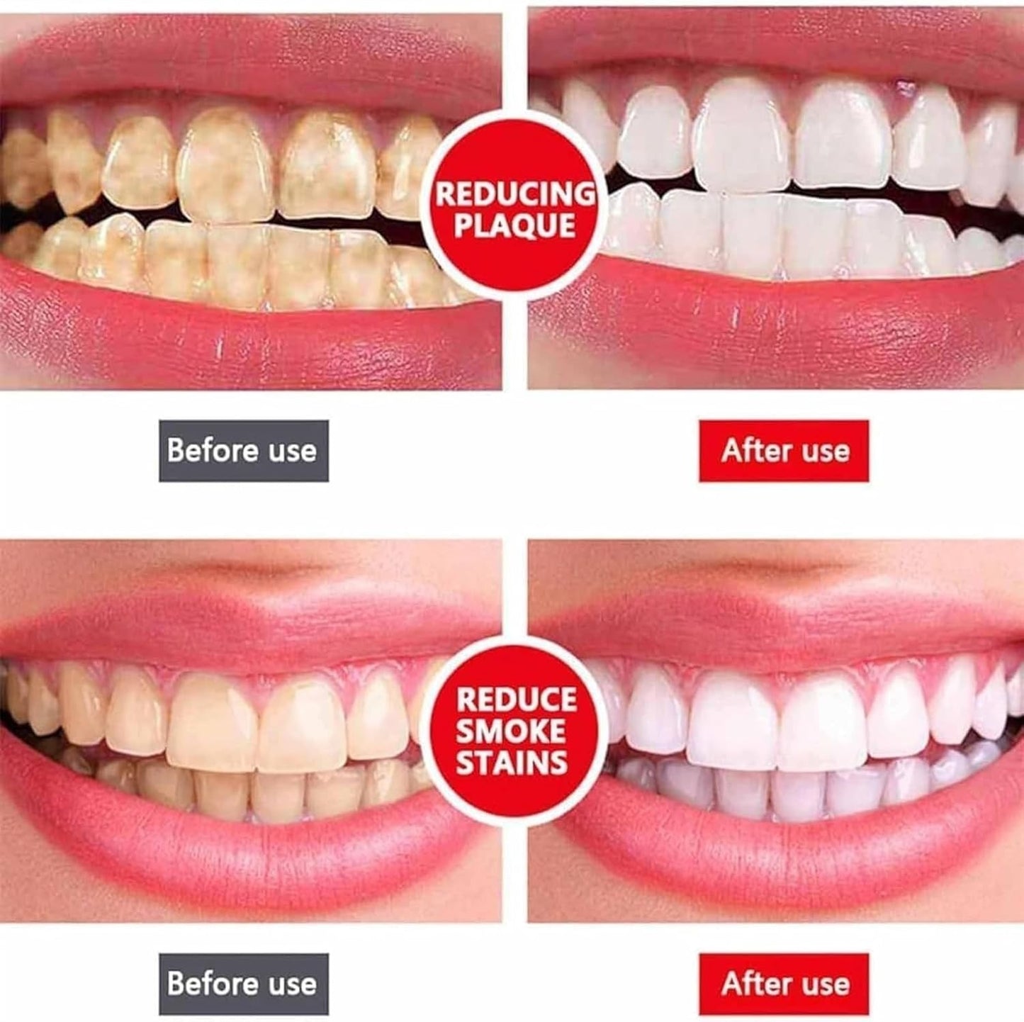 Yayashi Sp-4 Ultra Whitening Toothpaste Probiotic Stain Remover Stain Removing Toothpaste, Protects Gums Freshens Breath, for Everyone