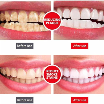 Yayashi Sp-4 Ultra Whitening Toothpaste Probiotic Stain Remover Stain Removing Toothpaste, Protects Gums Freshens Breath, for Everyone