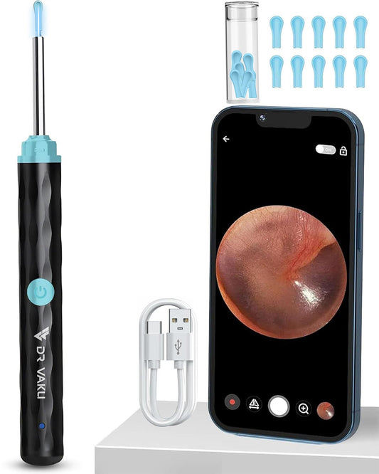 See Inside Your Ears Instantly – Smart HD Wireless Ear Camera with Live Mobile Display
